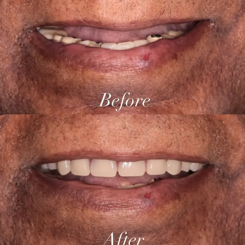 lazpqk7cikv3dze1pn8n