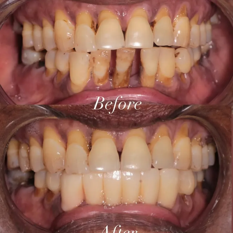 r5kpe1vyt6xmigcyayun