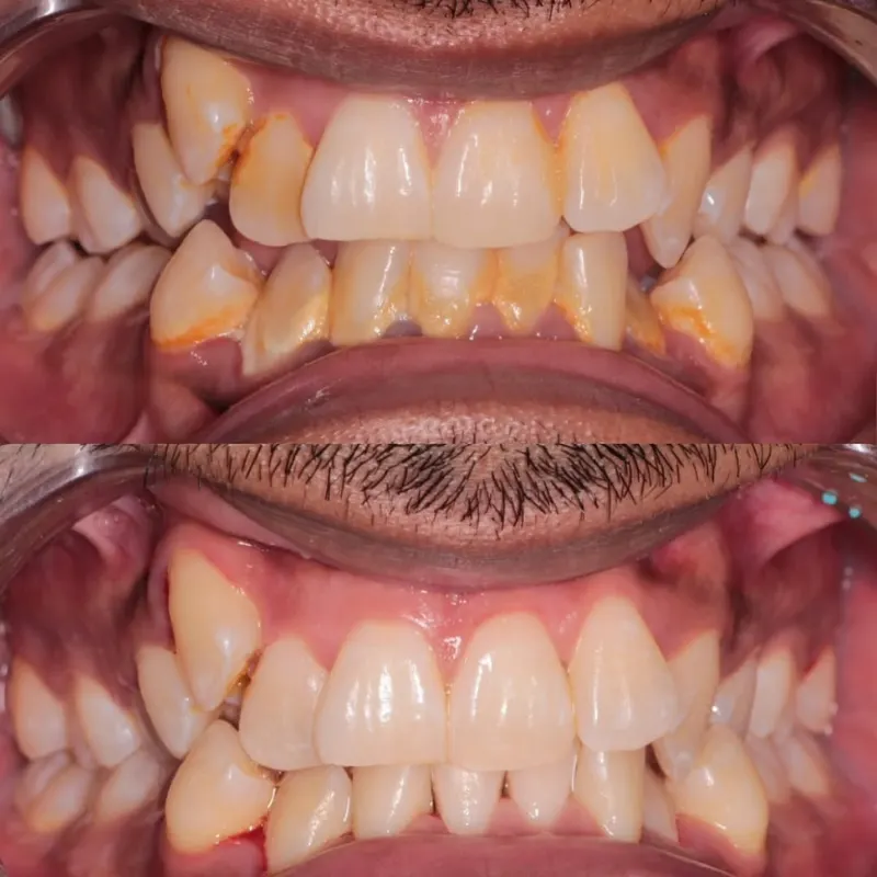 vng5hshkaf3p1stsvty5